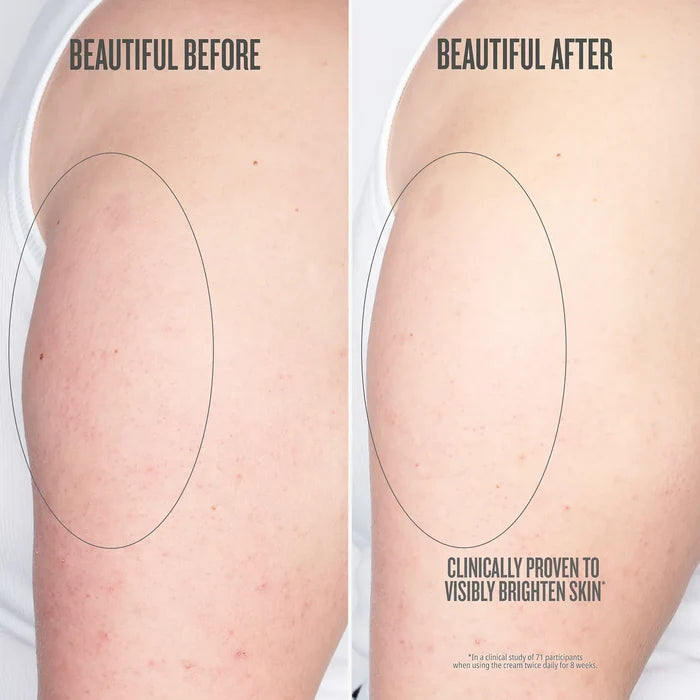 Before // After clinically proven to visibly brighten skin*