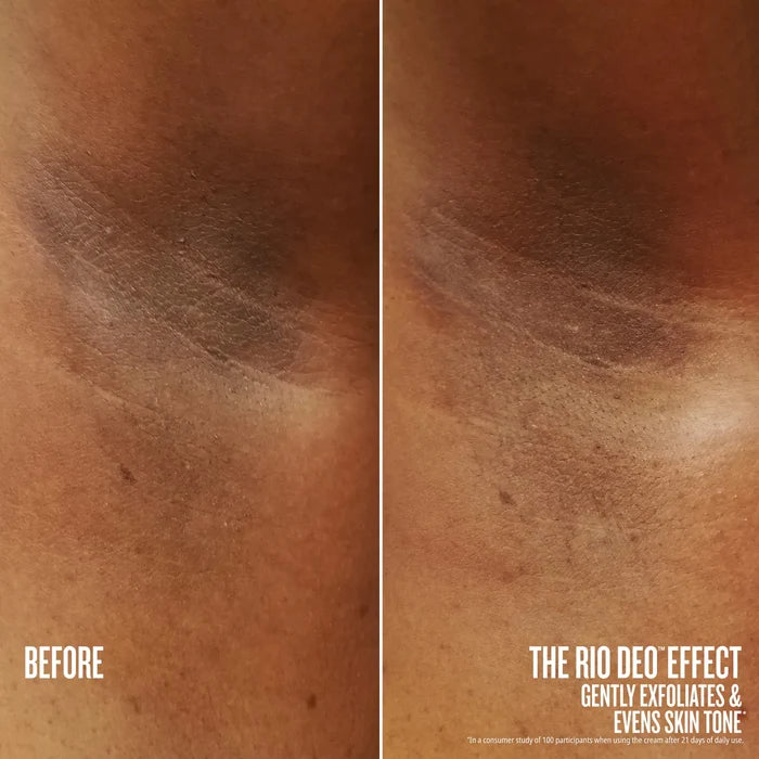 Before and after comparison of skin exfoliation with text indicating product effect.