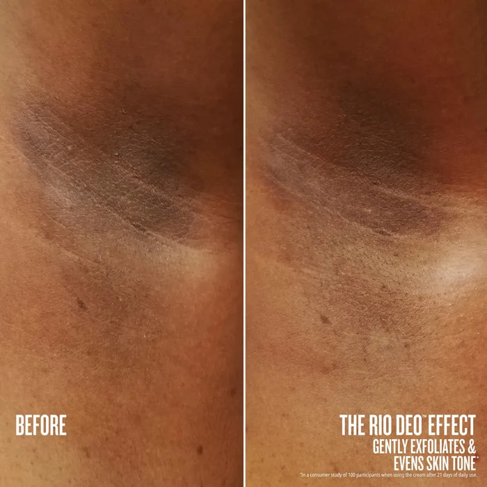 Before and after comparison of skin exfoliation with text indicating product effect.